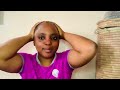Alopecia hair care routine | Lemon mask | Healing with food