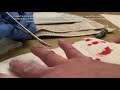 Gross Graphic Cut Knuckle Stitches Suture DIY At Home