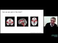 How does the brain generate pain? (Markus Ploner)