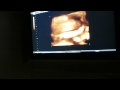 Sienna's 3D Ultrasound @ 28 Weeks