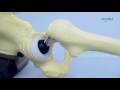 Total Hip Replacement System- Cemented