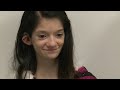 Teen girl hears for first time with brainstem implant