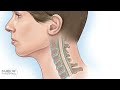 What is Degenerative Cervical Myelopathy?   Video Explanation