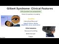 Gilbert Syndrome | Causes (Genetics), Pathogenesis, Signs & Symptoms, Diagnosis, Treatment