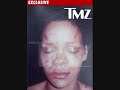 rihanna real horrible picture after chris brown attack her