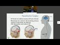 Neuro/Craniocervial Issues & Treatments for Ehlers-Danlos Syndrome