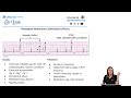 NCLEX® Tough Topics: ECG Interpretation