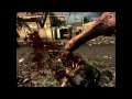 [Bloody Mess] Dead Island-Who do your voodoo