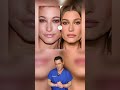 Hailey Bieber's Plastic Surgery Makeover #shorts