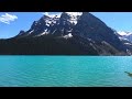 Hiking in Banff- Sulphur Mountain, Lake Agnes, Lake Louise, enjoying summer :)