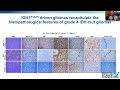 Molecular Evaluation & Treatment of Gliomas - Howard Colman, M.D.