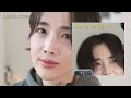 백만원 태운 얼태기 극복주간🧚🏻‍♀️feat.입술필러 성공하는 꿀팁⭐️(보톡스, 슈링크 유니버스, 백옥주사, 토닝, 홈케어...)