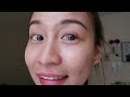 My Laser Eye Surgery in the UK | Little Pinay