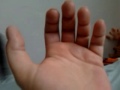 My Arthritic Left Hand