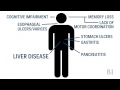 How Alcohol Affects Your Brain And Body