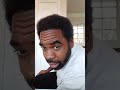 7 Month Update Black African Afro Americon FUT Hair Transplant (Crown)