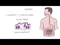 Understanding Coeliac Disease