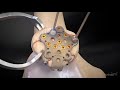 SuturePlate™ II Patella Fracture Repair System