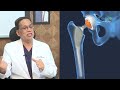 Arthritis: Symptoms, Causes, Types, Treatment & Prevention |  Dr. K J Reddy | Sakshi Life