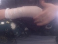 Broken wrist sorry doors :(