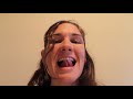 Tongue Exercises for Speech and Swallowing