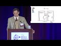 Alan Pocinki - Evaluation and Management of Fatigue in Patients with EDS