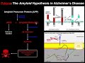 Prions | Mechanisms and Theories of Alzheimers Disease (Amyloid & Tau)
