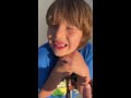 How Canadian kids remove teeth