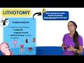 Lithotomy Position Nursing NCLEX Review