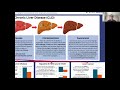 What Factors Cause Hispanic Men and Women to Have Chronic Liver Disease Rates... Eduardo A Canto