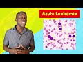 Disorders of Leukocytes/White Blood Cells - An Overview