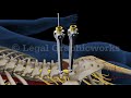 L5-S1 Lumbar Discectomy and Fusion Surgery 3D animation