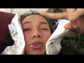 tooth extraction vlog