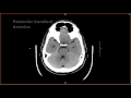 Introduction to CT Head: Approach and Principles