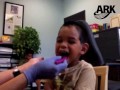 Jaw Stability Oral Motor Exercise with ARK's Grabber