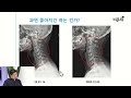 목디스크 통증에 꼭 해야 하는 것, 절대 하면 안 되는 것 / 서울마디튼튼재활의학과 김희상