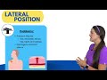 Lateral Position Nursing (Side-Lying) | Patient Positioning NCLEX