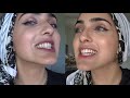 How To WHITEN Yellow Teeth NATURALLY & INSTANTLY AT HOME in 2 MINS | OIL PULLING ~ Immy