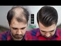 Hair Style For Very Thin & Balding Hair by using Hair Fibers 2022