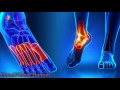 Nerve Healing Frequency: Peripheral Neuropathy Binaural Beats With Nerve Regeneration Sound Therapy