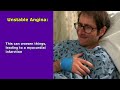 Angina Symptoms, Treatment Nursing NCLEX Review: Stable, Unstable, Variant Angina