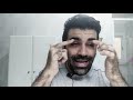 AFEITAR ESTROPEA MI BARBA DE MINOXIDIL | DREW SAYS