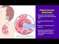 Congenital Heart Defects Nursing Mnemonics | Pediatric Nursing NCLEX Review Summary