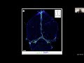 Immunological uniqueness of brain borders by Dr. Jony Kipnis