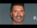 What Happened to Simon Cowell's Face? Doctor Reacts to Simon's Plastic Surgery!