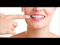 Como escovar os dentes com aparelho ortodôntico