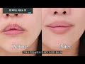 How to try picture perfect lips (fixing lip discoloration, overlining lips)