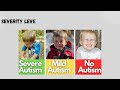 Autism spectrum disorder| DSM 5 TR| Neurodevelopmental Disorders....