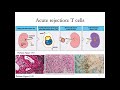 Immunology Lecture 32: Transplantation Immunology