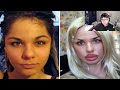 When Plastic Surgery RUINED People's LIVES